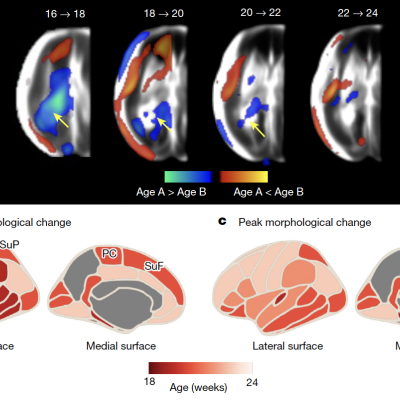 brain atlas 4